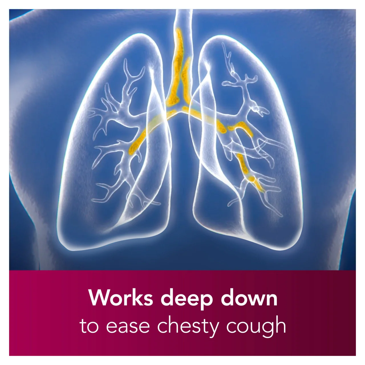 Benylin Chesty Coughs Original 300ml - Image 5